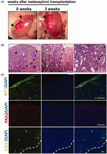 Figure 2. In vivo development of embryonic metanephros in acute nephrotoxic environment. (A) The process of transplanting metanephroi under the capsule, two metanephroi were transplanted to the renal capsule of AKI rats, and 3 weeks later, the grafts were found to be significantly larger and vascularized. (B) HE staining showed that mature glomeruli and tubules were detected in the grafts, the left side of the black dotted line is the graft and the right side is the host. (C) Histologic analysis revealed that WT-1-positive podocytes, PAX2-positive renal tubular cells, and CD31-positive vascular endothelial cells were detected in the grafts. G: graft; H: host; Bars: 100 μm.