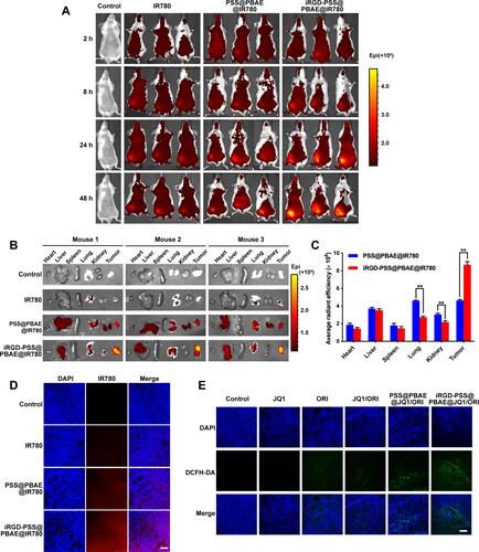 Figure 5 Biodistribution and tumor accumulation studies in 4T1 tumor-bearing mice. (A) The in vivo imaging photos of mice at different times after administrations. Tissue distribution and tumor-accumulation of IR780 encapsulated NPs in 4T1 tumor-bearing mice. (B) The fluorescent images of major organs and tumor tissues were removed from the mice at 48 h after intravenous injections of normal saline (the control), free IR780, PSS@PBAE@IR780 and iRGD-PSS@PBAE@IR780 NPs. (C) The comparisons of chemiluminescence image’s average radiant efficiency detected from major organs and tumor tissues at 48 h after administrations. ** indicate P<0.01 for comparison with the PSS@PBAE@IR780 NPs group. (D) The confocal images of intratumoral localization of IR780 encapsulated NPs at 24 h after various treatments. (E) The confocal images of intratumoral ROS generation after various treatments (Scale bar: 100 µm).