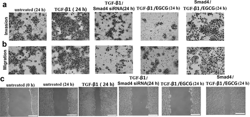 Figure 4. EGCG inhibits invasion and migration of 8505C cells via TGF-β/Smad4 Signal transduction pathway. 8505C cells were maintained in growth media supplemented with 5 ng/mL TGF-β with or without EGCG (60 μM) for 24 h. Or the 8505C cells were transfected with Smad4 siRNA or treated with Smad4 24 h before the TGF-β with or without EGCG treatment. (a) Boyden chamber assay performed to evaluate cell invasion; (b) Boyden chamber assay performed to evaluate migration; (c) Cell migration determined by the wound-healing assay. Magnification ×100 and scale bars = 100 μm.