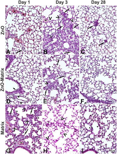 Figure 2. Examples of histological changes in the lung of mice on day 1 (A, D, G), 3 (B, E, H), and 28 (C, F, I) after intratracheal instillation with 2 µg/animal of ZnO (A–C), ZnO-Matrix (D–F), or Matrix (G–I). Asterisks: congestion. Long arrows: leukocytic infiltration in alveolar lumina and walls. Short thin arrows: proliferation of epithelial bronchiolar cells. Short thick arrows: perivascular and peribronchiolar edema. Head arrows: alveolar wall widening. V: exudate in lumen of some alveoli. HE staining, magnification as on the scale in I. An example of a normal structure of the mouse lung is presented in Supplementary Figure S2(A).