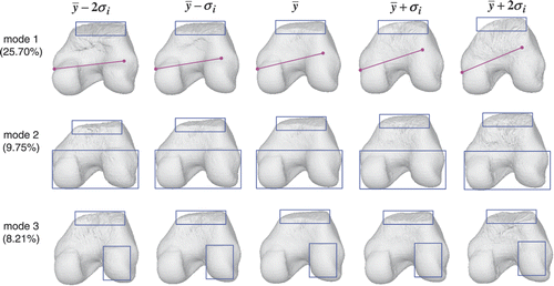 Figure 15. Condyle atlas: illustration of the shape variation in the first, second and third modes. The first mode encodes 25.70% of the shape variation, while the second and third modes encode 9.75% and 8.21% of the shape variation, respectively. The color shapes highlight the local shape variation.