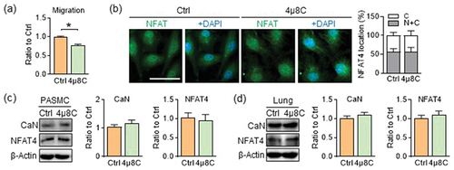 Figure 5. The activation of CaN/NFAT4 is independent of IRE1α/XBP1s pathway in SKI. (a) migration. n = 7–8. (b) Representative images of NFAT4 (green) immunofluorescence staining in SKI PASMCs treated with 4μ8C, and quantitative the proportion of cells with NFAT4 in the nucleus in the graph. Nuclei are indicated by DAPI (blue), n = 6. Scale bar: 50 μm. (c) Representative western blots of SKI PASMCs treated with 4μ8C, and quantification of band intensities in the graph, n = 5. (d) Representative western blots of SKI lung tissues treated with 4μ8C, and quantification of band intensities in the graph, n = 8. Data shown are means ± SEM. NFAT4 immunofluorescence staining, two-way ANOVA with Bonferroni’s multiple comparisons test; others, unpaired t test; *P < .05, 4μ8C vs. solvent control (Ctrl).