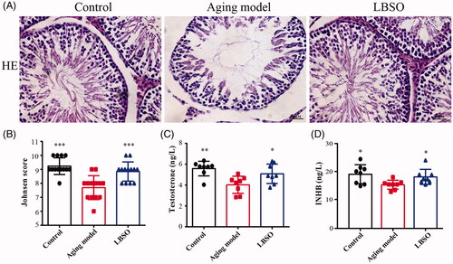 Figure 3. Function of testis was improved by LBSO. (A) Histomorphological changes in the testicular tissue of rats with LBSO. (B) Grades of testicular tissues depend on the Johnsen score. (C) Endocrine testosterone was detected in the rat serum. (D) Secretory cytokine level of INHB was measured in the rat serum.