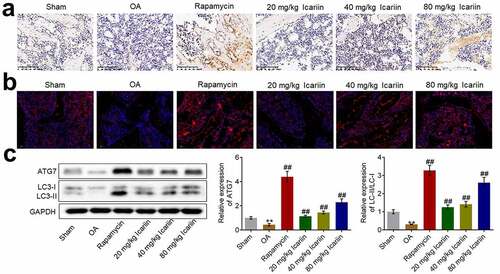 Figure 6. Icariin activated autophagy in OA chondrocytes. (a). Beclin-1 expression level was measured using an immunohistochemical assay. Beclin-1 was upregulated in the rapamycin and icariin groups. (b). LC3 expression was visualized using an immunofluorescence assay. LC3 was upregulated in the rapamycin and icariin groups. (c). Western blotting was used to assess the expression of ATG7, LC3-I, and LC3-II in cartilage tissues. ATG7 and LC3-II/LC3-I levels were elevated in the rapamycin and icariin groups (**p < 0.01 vs. Sham, ##p < 0.01 vs. OA). Data are presented as means ± SD (n = 6)