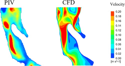 Figure 2. Velocity field reconstructed from PIV measurements and simulated using CFD in base model at the region of interest (see Figure 1a).