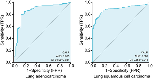 Figure 3. ROC curve (AUC) of CALR in the diagnosis of LUSC and LUSD data from TCGA database.