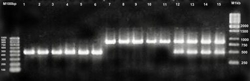 Figure 1 Amplification profiles of PCR products (25S rDNA) of Candida albicans isolates.