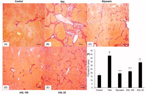 Figure 6. Effect of ASL on TAA-induced fibrosis by Picrosirius red stain of liver tissues. (A) Control group, (B) TAA: TAA-induced liver fibrosis rats, (C) silymarin: positive control rats, (D) ASL 100: TAA plus ASL 100 mg/kg treated rats, (E) ASL 25: TAA plus ASL 25 mg/kg treated rats and (F) percentage of fibrosis area plot. Scale bar = 200 μM. Quantification was done using ImageJ. Values are represented as mean ± SEM (n = 10) using one-way ANOVA followed by Student’s t-test. #p < 0.001 as compared with control group, **p < 0.01, ***p < 0.001 as compared with TAA group. TAA: Thioacetamide.