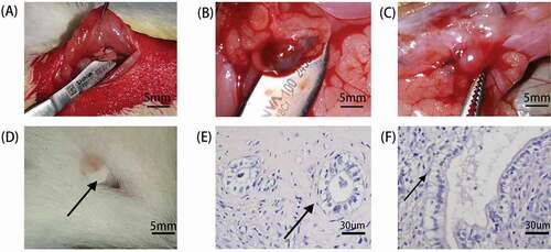 Figure 1. Establishment and results of endometriosis model. (A) The left uterine horn was ligated and excised. The endometrium was exposed along its antimesenteric axis, and 5*5 mm sections were cut. The trimmed endometrial piece was sutured to the inner side of the abdominal wall. (B) Ectopic mass in the abdominal cavity of rats in the endometriosis group. (C) Ectopic mass in the abdominal cavity of rats in the letrozole group. (D) Vaginal plug, a marker of mating between male and female rats. Mating can promote ovulation in female mice, allowing the endometrium to enter the window of implantation. (E) The gland of ectopic mass in the endometriosis group (Hematoxylin-eosin staining, 200×). (F) The gland of ectopic mass in the letrozole group (Hematoxylin-eosin staining, 200×).