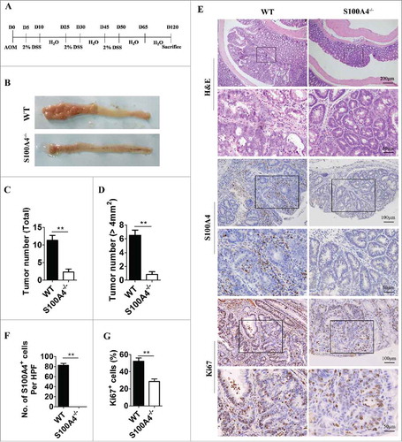Figure 4. S100A4 deficiency decreases colorectal tumorigenesis. (A) Schematic overview of the experimental CAC model using S100A4−/− and WT control littermates. (B) Representative photographs of the colon from S100A4−/− and WT mice on day 120 of age. (C) The tumor number of the entire colon was counted, and each tumor size was measured. Total tumor incidence and (D) incidence of tumors over 4 mm2 in S100A4−/− and WT mice are shown. (E) The colon sections of CAC were stained with H&E, S100A4 and Ki67. Representative images are shown. (F) The number of S100A4+ cells in tumors per HPF (×200) and (G) percentages of Ki67+ cells in tumors are shown. *P < 0.05, **P < 0.01.