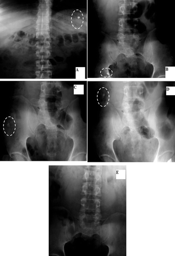 Figure 9.  Localization of F17 throughout the GIT: A: Stomach after 20 min. B: Ileum after 3 hrs. C: Ascending colon after 5 hrs. D: Transverse colon after 8 hrs. E- Disappeared.
