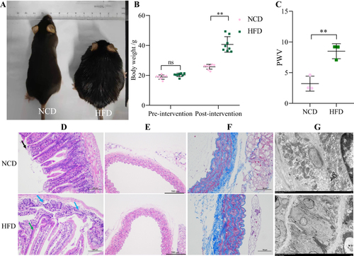 Figure 4 Body weight and pathological changes. (A) Gross morphology of representative mice in the NCD and HFD groups. (B) Body weight changes of mice in the NCD and HFD groups. (C) Aortic arch pulse wave velocity (PWV). (D) HE staining of small intestinal tissues. Black arrow: mucosal epithelial cells at the tip of the intestinal villi are shed. Blue arrow: loss of glandular structures. Green arrow: loss of intestinal villi. (E) HE staining of aortic tissue. (F) Masson staining of aortic tissue. (G) Aortic transmission electron microscopy. **P < 0.01.