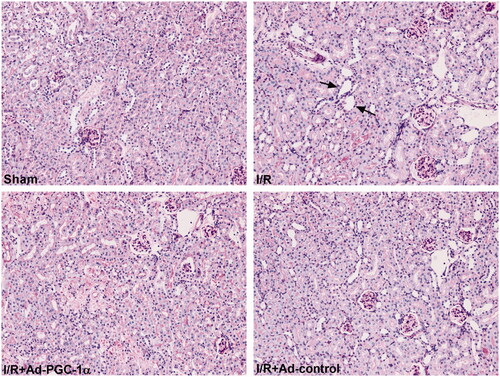 Figure 3. PGC-1α overexpression attenuated renal tubulointerstitial damage. Histological changes of kidney in each group by PAS (×200). Black arrow: brush border loss and tubular dilation.