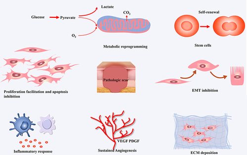 Figure 2 Pathogenesis of hypertrophic scars and keloids.