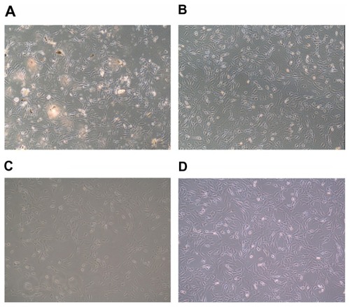 Figure 6 Influence of incubation with different formulations: (A) tincture; (B) aqueous suspension; (C) microemulsion; and (D) microemulsion without Evo and Rut on cellular morphology.