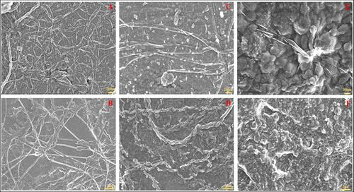 Figure 3 SEM images of nanocollagen study groups: (A and B) Pure NC, (C and D) NC + 0.005% GO, and (E and F) NC + 0.01% GO, respectively. Pure NC displayed free NC strands whereas samples with GO demonstrated particles attached to GO sheets and free NC strands.