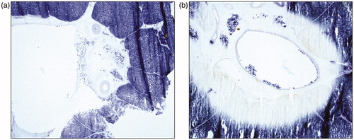 Figure 6. Nicotinamide adenine dinucleotide (NADH) staining. Extension of the ablation zone in the perivascular region demonstrated by zone of absent blue formazan deposit in the nuclei as well as the cytoplasm in the perivascular zone in a vessel with extension of MWA.