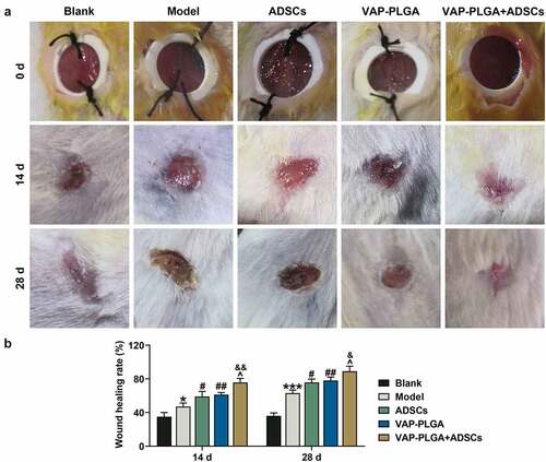 Figure 7. Velvet antler polypeptide (VAP)-PLGA promoted adipose-derived stem cell (ADSC)-induced wound healing in chronic skin ulcers in vivo. (a and b) The therapeutic effects of ADSCs or/and VAP (PLGA microspheres) on wound surface in chronic skin ulcers in vivo were evaluated by observing pathological changes on the 0, 14th, and 28th days. (a) The wound healing rate on the 28th day (b). The average data from three independent experiments were shown as mean ± standard deviation. *p < 0.05 or ***p < 0.001 vs. Blank; #p < 0.05 or ##p < 0.01 vs. Model; ^p < 0.05 vs. ADSCs; &p < 0.05 vs. VAP-PLGA