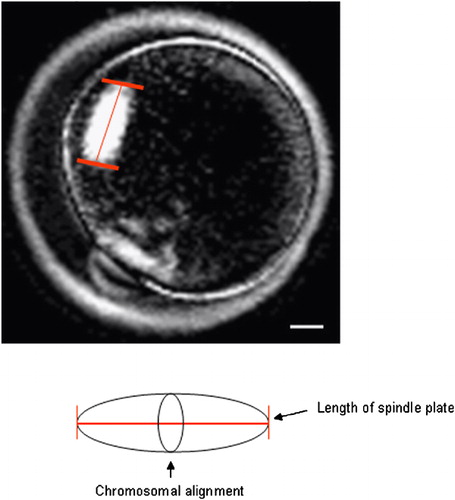 Figure 1 Measurement for the length of spindle plate of mouse oocyte using the PolScope imaging system. The length of spindle plate was measured by crossing the chromosomal alignment (arrow). Scale bar indicates 10 μm.