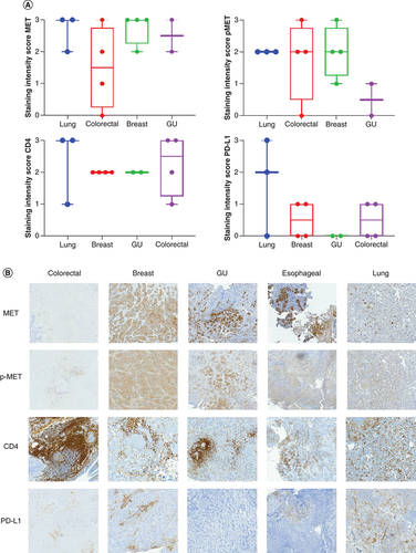 Figure 1. MET IHC scores.(A) Box plot representing the staining intensity IHC scores of c-MET, p-MET, PD-L1 and CD4 per disease type (lung, colorectal, breast and GU cancer). IHC staining of lung, colorectal, breast and GU tumor tissue with MET, p-MET, CD4 and PD-L1 antibodies was scored on a scale from 0 (no staining/no protein expression) to 3+ (strong staining/high protein expression). Staining intensity scores of MET, p-MET, CD4 and PD-L1 are mean ± SE. Statistical analyses were conducted using GraphPad Prism 8 by one-way ANOVA, followed by Tukey's multiple comparison test. No significant differences were seen between groups. (B) IHC staining of MET, p-MET, CD4 and PD-L1 for each disease type (colorectal, breast, GU and lung cancer).ANOVA: Analysis of variance; GU: Genitourinary; IHC: Immunohistochemical; SE: Standard error.