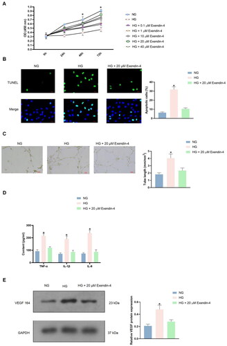 Figure 1. Exendin-4 alleviates HG-induced cell injury. (A) HRECs were treated with different concentrations of Ex4, and cell viability was determined using the CCK-8 assay. (B) The apoptosis of HRECs was evaluated using the TUNEL assay. DAPI staining indicates the cell nucleus (blue); Fitc-labelled nuclei appeared positive (green). (C) The tube formation ability of HRECs was determined using the tube formation assay. (D) The levels of inflammatory cytokines, such as TNF-α, IL-1β, and IL-6, in HRECs, were detected using ELISA. (E) VEGF protein levels in HRECs were detected using western blotting. * Comparison with NC, P < 0.05.