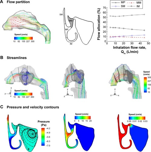 Figure 2 Airflow dynamics in the nasal-sinus airway.Notes: (A) <10% of inhaled air is ventilated into the middle meatus. (B) Even less portion (<0.1%) of inhaled air is ventilated into the sinus. Only airflows originated at the middle outer nostril can possibly enter the sinus; airflows originated at other regions will pass through the median passages of the nose. (C) There is almost no pressure difference between the ostium and sinus. The airflow motion inside the sinus is extremely slow relative to the flows in the main nasal chamber.Abbreviations: SM, superior meatus; MM, middle meatus; MP, median passage; IM, inferior meatus.