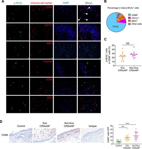 Figure 4 Prominent p-MLKL expression in macrophages in CRSwNP. (A) IF staining of p-MLKL (green) with specific immune cell markers (red) in nasal polyp sections. Arrows indicate double positive cells. The sections were counterstained with DAPI (blue). Scale bars: 20 μm. (B) The mean percentages of different cell types expressing p-MLKL in total p-MLKL+ cells in nasal polyps were shown (n=11). (C) The mean percentages of p-MLKL+ cells in total CD68+ cells were calculated in nasal polyps (n=10). (D) IHC staining of CD68 in control tissues and nasal polyps. The positive cells were counted over high power field (400×) (n=10–11 per group). Scale bars: 50 μm. The data were shown as mean±SEM. ***p<0.001, ****p<0.0001; by Mann–Whitney U 2-tailed test.