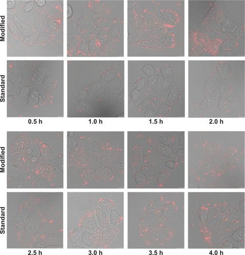Figure 6 Time lapse images of the cellular uptake of polyplex. Hep G2 cells cultured in a 24-well plate were transfected with the polyplex containing 0.8 μg TOTO®-3-labeled pGL3-control and polyethyleneimine (N/P=10) using both methods. Time lapse images of the internalization of the polyplex were taken at every 0.5 hour using confocal laser scanning microscopy. Scale bar: 10 μm.