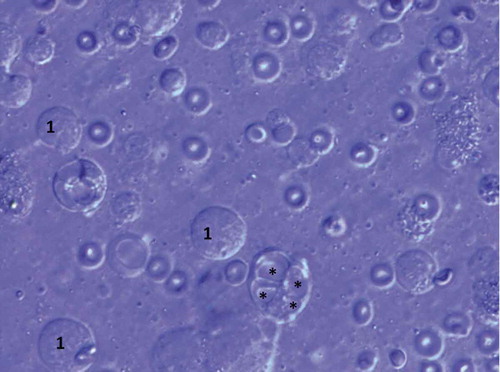 Figure 2. Morphology of testicular germ cells showing primary spermatocytes (1) and vacuolar degeneration (*) (stained with Giemsa). Olympus BX41 microscopy (1000X)