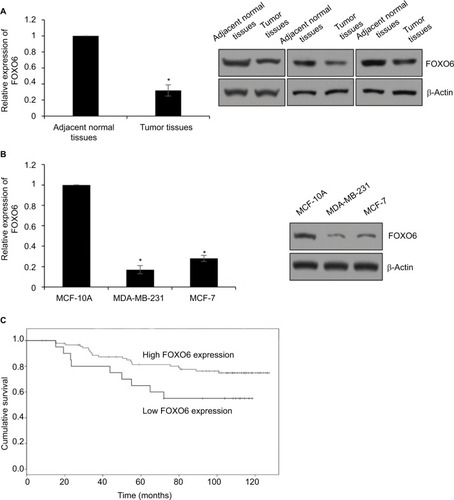 Figure 1 FOXO6 is downregulated in breast cancer tissues and associated with EMT-associated proteins E-cadherin and N-cadherin.Notes: (A) The expression of FOXO6 in tumor tissues and adjacent normal tissues was detected by qRT-PCR and Western blotting analysis, respectively. Tumor tissues vs adjacent normal tissues, *p < 0.05. (B) The expression of FOXO6 in breast cancer cell lines was detected by qRT-PCR and Western blotting analysis, respectively. Human normal breast MCF-10A cells were used as control. MDA-MB-231 or MCF-7 vs MCF-10A, *p < 0.05. (C) Kaplan–Meier analysis was used to analyze overall survival according to the expression status of FOXO6 (log-rank).Abbreviations: EMT, epithelial–mesenchymal transition; qRT-PCR, quantitative real-time polymerase chain reaction; FOXO, forkhead transcription factor family.