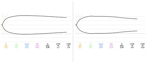 Figure 1. Graphical representation of a TEG performed on the blood of a healthy dog (left) and on the same patient following the addition of etamsylate 250 μM (right). The most significant finding is an increase in the percentage of clot lysis at 30 min (LY30) and 60 min (LY60).