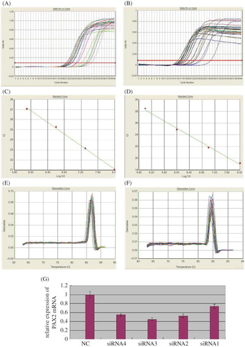 Figure 4. Real-time quantitative PCR analysis of PAX2 mRNA expression. (A) PAX2 amplification curve. (B) GAPDH amplification curve. (C) PAX2 standard curve, Ct = −2.884167 × Log10 C0 + 44.182236 (C0: the starting copy number). (D) GAPDH standard curve, Ct = −3.088276 × Log10 C0 + 43.657402 (C0: the starting copy number). (E) PAX2 dissociation curve, solution temperature is 87°C. (F) GAPDH dissociation curve, solution temperature is 84°C. (G) mRNA transcription of PAX2 in UUO assessed by real-time PCR after PAX2-siRNA-PEI was transfected. The normalized PAX2 mRNA level of negative control-siRNA-PEI was taken as 1.0.