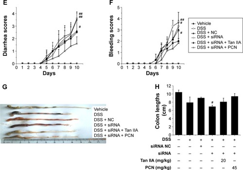 Figure 8 Clinical assessment of dextran sulfate sodium (DSS)-induced inflammatory bowel disease (IBD) in vehicle-, DSS-, siRNA-, siRNA NC-, Tan IIA-, and PCN-treated PXR lacking mouse model.