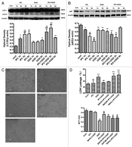 Figure 1. Preconditioning-induced autophagy activation contributes to neuroprotection in primary cultured cortical neurons. In IPC groups, cortical neurons were subjected to OGD for 30 min and then reperfused for 1–6 h. In OGD groups, neurons were deprived of oxygen and glucose for 1–6 h. In IPC+OGD groups, neurons were preconditioned for 30 min and exposed to OGD 24 h later for 1?6 h. The protein levels of LC3 and p62 were detected with immunoblotting. Levels of β-actin protein were used as the loading control. Quantitative analysis was performed with Sigma Scan Pro 5. (A) Protein expression of LC3. (B) Protein expression of p62. (C and D) 3-MA abolished IPC mediated neuroprotection in primary cultured cortical neurons. Cortical neurons were pre-incubated with 3-MA (5–20 mM) or BAF (37.5–150 nM) 30 min before the onset of IPC. After 24 h of reperfusion, a lethal OGD was induced by deprivation of oxygen and glucose for 6 h. The cell injury was evaluated by morphological changes and LDH leakage and MTT assay. (C) Cell morphological changes were observed with phase contrast microscopy. Bar = 50 μm. (D) 3-MA increased the LDH leakage of the cortical neurons. 3-MA (S) = 3-MA 5 mM; 3-MA (M) = 3-MA 10 mM; 3-MA (L) = 3-MA 20 mM. (E) Bafilomycin A1 (BAF) abolished the IPC elicited neuroprotection in cortical neurons. BAF (S) = BAF 37.5 nM; BAF (M) = BAF 75 nM; BAF (L) = BAF 150 nM. Bar represents mean ± SD, n = 6. *p < 0.05, **p < 0.01 vs. control group; #p < 0.05, ##p < 0.01 compared with the OGD group at each time point; $$p < 0.01 vs. IPC+OGD group.