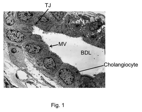 Figure 1. Electron microscopic image showing the cross section of bile duct. TJ, tight junction; N, nucleus; BDL, bile duct lumen; MV, microvilli. The image was obtained, with permission, from Electron Microscopic Atlas of Cells, Tissues and Organs by Dr. Holger Jastrow, University of Maintz, Germany.