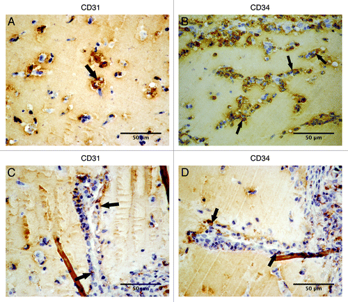 Figure 5. Cellular phenotypes colonizing matrigel plugs implanted with fibroblasts after one week of implantation. Representative images of stainings for CD31 and CD34: (A) microvessels formation, with arrows showing CD31 staining; (B) microvessels formation, with arrows indicating CD34 staining; (C and D) consecutives images [(C), CD31 staining; (D), CD34 staining], with arrows showing the vessels formed from the periphery to inside the plug.