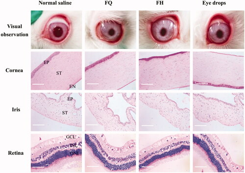 Figure 4. Representative histological images of the eye tissues after treated with various formulations for a week (original magnification, ×200). EP: epithelium; ST: stroma; EN: endothelium; ONL: outer nuclear layer; INL: inner nuclear layer; GCL: ganglion cell layer.