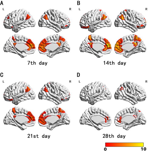 Figure 2. The ReHo in medial prefrontal cortex, ACC, posterior cingulate cortex, precuneus, angular gyrus, and bilateral OFC after the administration of ketamine. (A) 7 days, (B) 14 days, (C) 21 days, and (D) 28 days.