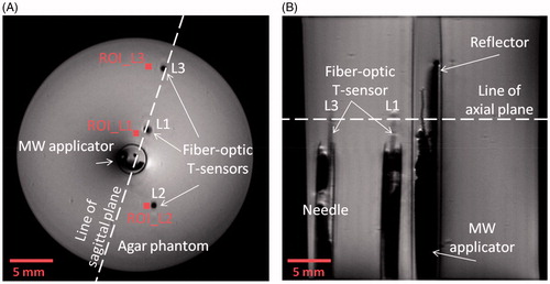 Figure 5. T1-RARE images of the antenna in agar phantom. (A) Axial view and (B) sagittal view through the dotted line shown in (A).