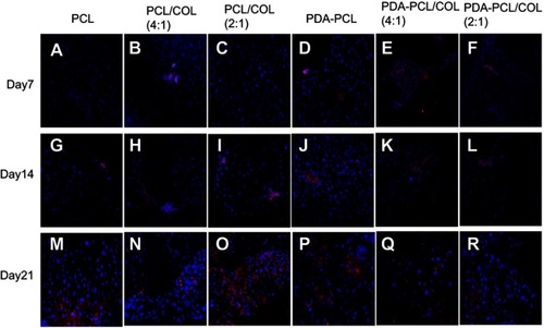 Figure 10 Ocn expression using immunofluorescent staining assay. (A, G, M) TSPCs cultured on PCL for day7, day14, day21. (B, H, N) TSPCs cultured on PCL/COL (4:1) for day7, day14, day21. (C, I, O) TSPCs cultured on PCL/COL (2:1) for day7, day14, day21. (D, J, P) TSPCs cultured on PDA-coated PCL for day7, day14, day21. (E, K, Q) TSPCs cultured on PDA-coated PCL/COL (4:1) for day7, day14, day21. (F, L, R) TSPCs cultured on PDA-coated PCL/COL (2:1) for day7, day14, day21, scale bars: 50 µm.Abbreviations: TSPCs, tendon stem/progenitor cells; PCL, polycaprolactone; COL, collagen; PDA, poly(dopamine); Ocn, osteocalcin.