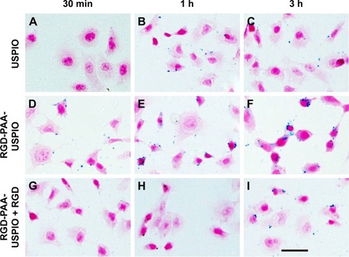 Figure 2 Cellular uptake of particles in HUVECs evaluated by Prussian blue staining.Notes: The plain USPIO (A–C), RGD-PAA-USPIO (D–F), and RGD-PAA-USPIO + RGD (competition, G–I) were incubated with HUVECs at an iron concentration of 0.03 μmol mL−1 for different time intervals (30 min, 1 h, and 3 h). Scale bar: 10 μm.Abbreviations: HUVEC, human umbilical vein endothelial cell; PAA, polyacrylic acid; RGD, arginine-glycine-aspartic acid; USPIO, ultrasmall superparamagnetic iron oxide.