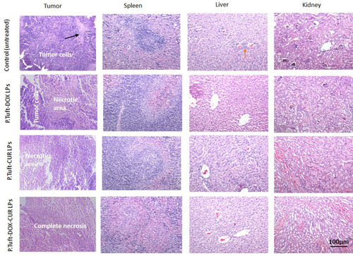 Figure 11 The micrographs of H&E-stained sections of the main organs and tumors after treatment with different kinds of LPs.