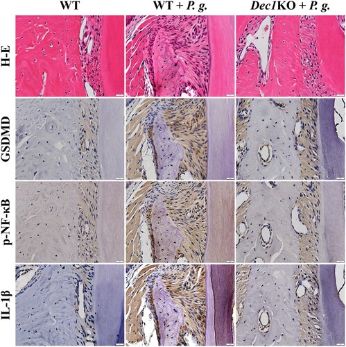 Figure 4. The absence of Dec1 reduces pyroptosis in P. gingivalis-induced periodontitis in mice. Immunohistochemistry showing that the expression of GSDMD, p-NF-κB and IL-1β in the periodontal ligament of WT and Dec1KO mice was suppressed by the absence of Dec1. Original magnification: 60×, scale bars = 20 µm. All results are representative of at least three independent experiments.