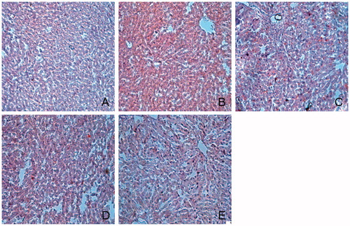 Figure 4. Histological examination of liver in Oil red O staining. (A) Normal; (B) control diabetic; (C) diabetic + TGP 50 mg/kg; (D) diabetic + TGP 100 mg/kg; (E) diabetic + TGP 200 mg/kg. Original magnification 100×.