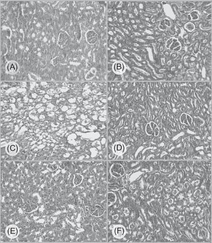 Figure 3.  The images (magnification × 100) of the kidney tissue. (A) group 1: male, losartan + CP; (B) group 2: female, losartan + CP; (C) group 3: male, CP; (D) group 4: female, CP; (E) group 5: male, saline; and (F) group 6: female, saline. More tissue damage was observed in female losartan + CP and male CP-treated groups.