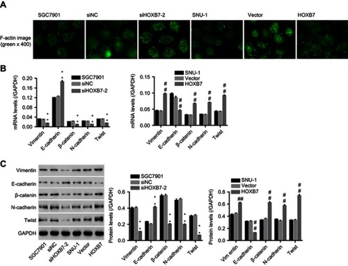 Figure 3 Effect of HOXB7 on epithelial–mesenchymal transitio (EMT).Notes: After transfection, (A) F-actin cytoskeleton was observed using immunofluorescence (400×). (B) mRNA and (C) protein expression of EMT markers (E-cadherin, N-cadherin, vimentin, β-catenin, and Twist) in siHOXB7-2/siNC, or HOXB7/vector-transfected cells. **P<0.01 versus SGC7900 cells transfected with siNC; ##P<0.01 versus SNU-1 cells transfected with vector.