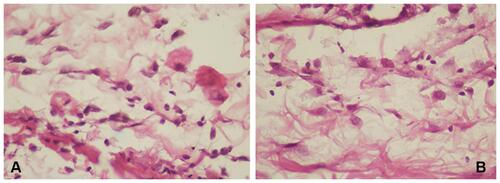 Figure 4 Number of macrophages using hematoxylin-eosin staining. (A) control group; (B) treatment group (observed using a light microscope with 400x magnification).