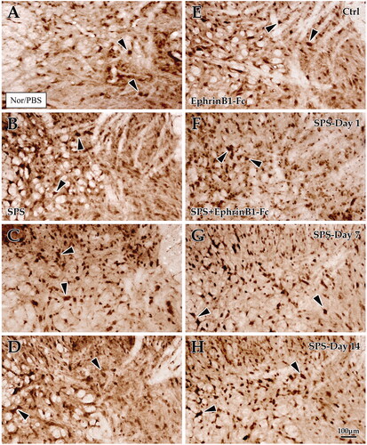 Figure 6. Immunohistochemical exploration of C-Fos in the spinal dorsal horn. Panels (A–D) show C-Fos + cells in the dorsal horn of the lumbar cord of the control group (A), Day 1 group (B), Day 7 group (C), and Day 14 group (D) in SPS. Panels (E–H) correspond to the SPS + EphrinB1-Fc of the control group (E), Day 1 group (F), Day 7 group (G), and Day 14 group (H). “Ctrl” corresponds to the control, and Day 1, Day 7, and Day 14 correspond to days 1, 7, 14 after SPS, respectively. All images are at the same magnification, scale bar = 100 μm. Black arrows indicate positive cells.