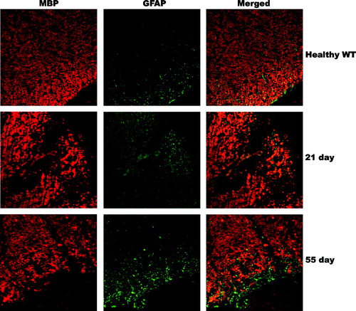 Figure 10 Fewer GFAP-expressing astrocytes are present in demyelinating lesions and more are present in recovering lesions. Spinal cord tissue was labeled for GFAP (green) and MBP (red) to show the presence of reactive astrocytes within demyelinating versus recovering lesions. Demyelinating lesions for both genotypes have fewer reactive astrocytes, and recovering lesions of both genotypes have increased GFAP-expressing astrocytes. Images of WT animals shown. Magnification 630X.