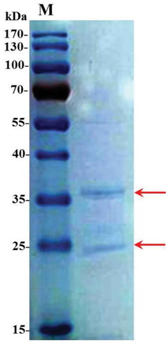 Figure 4. 1D SDS-PAGE of proteins in G. biloba PDs.